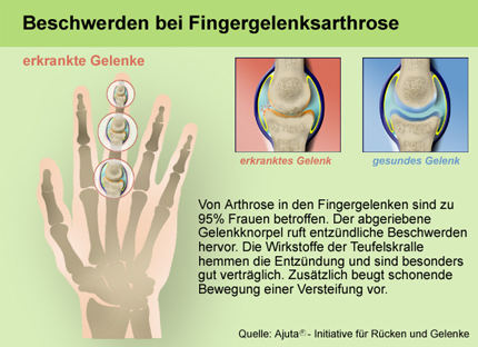 Gelenk&uuml;bungen